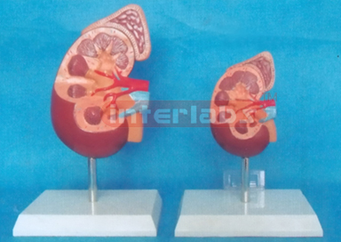 ANATOMICAL KIDNEY MODEL WITH ADRENAL GLAND